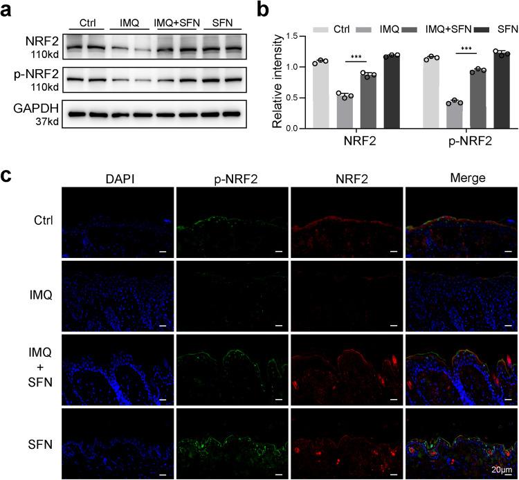 https://cdn.ncbi.nlm.nih.gov/pmc/blobs/aae6/10676357/40b115397b6d/41419_2023_6234_Fig6_HTML.jpg