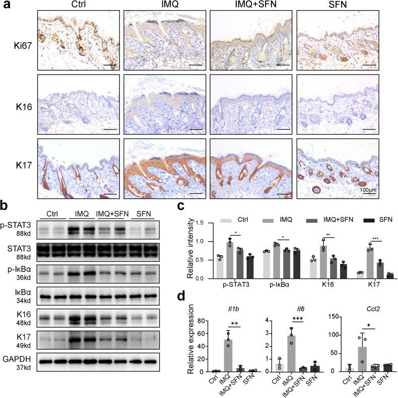 https://cdn.ncbi.nlm.nih.gov/pmc/blobs/aae6/10676357/494c6e46730b/41419_2023_6234_Fig2_HTML.jpg