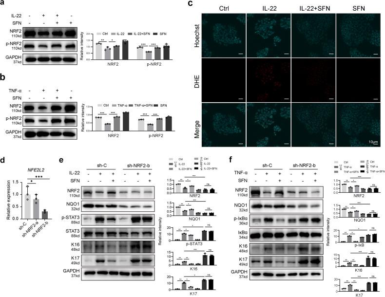 https://cdn.ncbi.nlm.nih.gov/pmc/blobs/aae6/10676357/9de5cf89fbfc/41419_2023_6234_Fig7_HTML.jpg