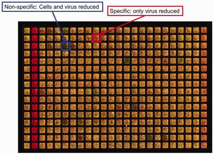 https://cdn.ncbi.nlm.nih.gov/pmc/blobs/aaed/6376503/8b8b2120f869/10.1177_2040206619830197-fig3.jpg