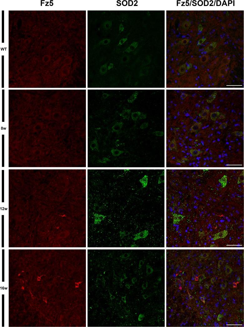 https://cdn.ncbi.nlm.nih.gov/pmc/blobs/aaee/4871528/9d04138986fd/pone.0155867.g007.jpg