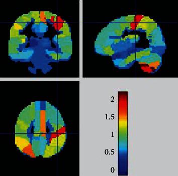 https://cdn.ncbi.nlm.nih.gov/pmc/blobs/aaf2/9225908/5cf36cdad755/DM2022-1210002.001.jpg