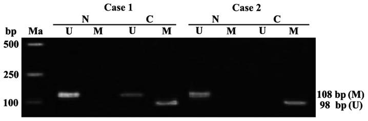 https://cdn.ncbi.nlm.nih.gov/pmc/blobs/aaf4/5530209/79c7429549a0/ol-14-02-2315-g00.jpg