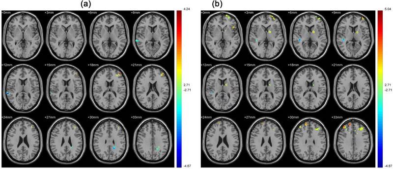 https://cdn.ncbi.nlm.nih.gov/pmc/blobs/aafa/10338816/0127e865e18c/BRB3-13-e3059-g002.jpg