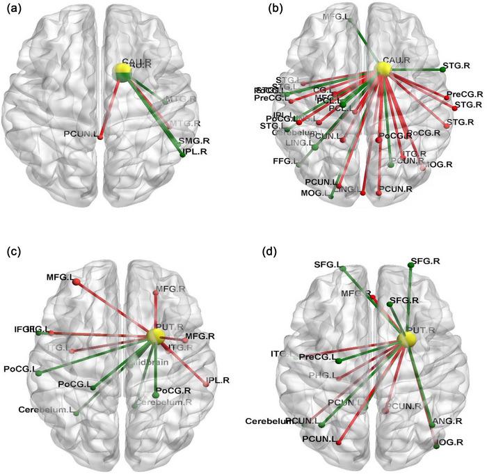 https://cdn.ncbi.nlm.nih.gov/pmc/blobs/aafa/10338816/2e976b931e51/BRB3-13-e3059-g004.jpg