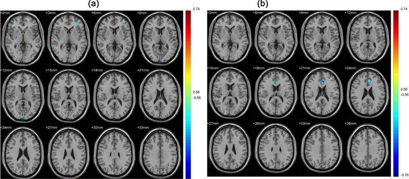 https://cdn.ncbi.nlm.nih.gov/pmc/blobs/aafa/10338816/4cb1366429c5/BRB3-13-e3059-g001.jpg