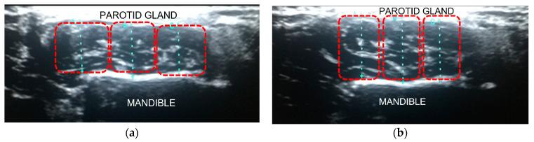 https://cdn.ncbi.nlm.nih.gov/pmc/blobs/aafd/10608340/03ebe17031a5/jpm-13-01467-g002.jpg