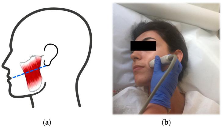 https://cdn.ncbi.nlm.nih.gov/pmc/blobs/aafd/10608340/5d110838ca6a/jpm-13-01467-g001.jpg