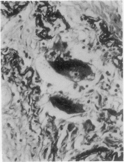https://cdn.ncbi.nlm.nih.gov/pmc/blobs/ab00/470850/b1f4b0c0eead/thorax00157-0086-a.jpg