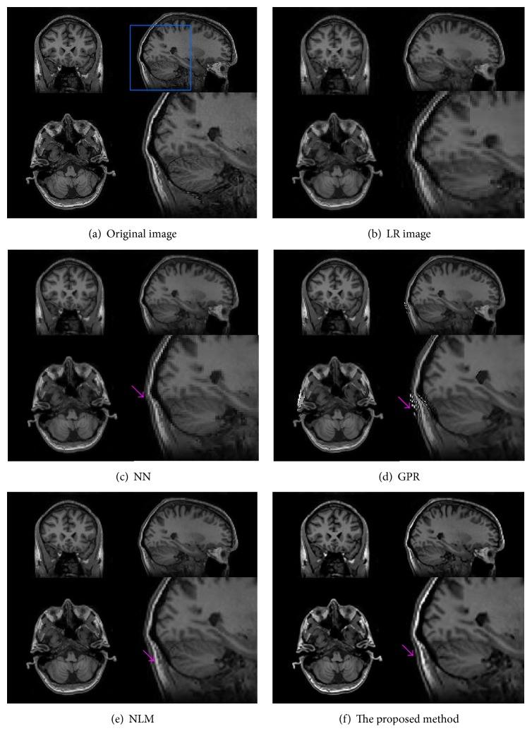 https://cdn.ncbi.nlm.nih.gov/pmc/blobs/ab02/5390603/08208022ae0b/CMMM2017-6462832.005.jpg