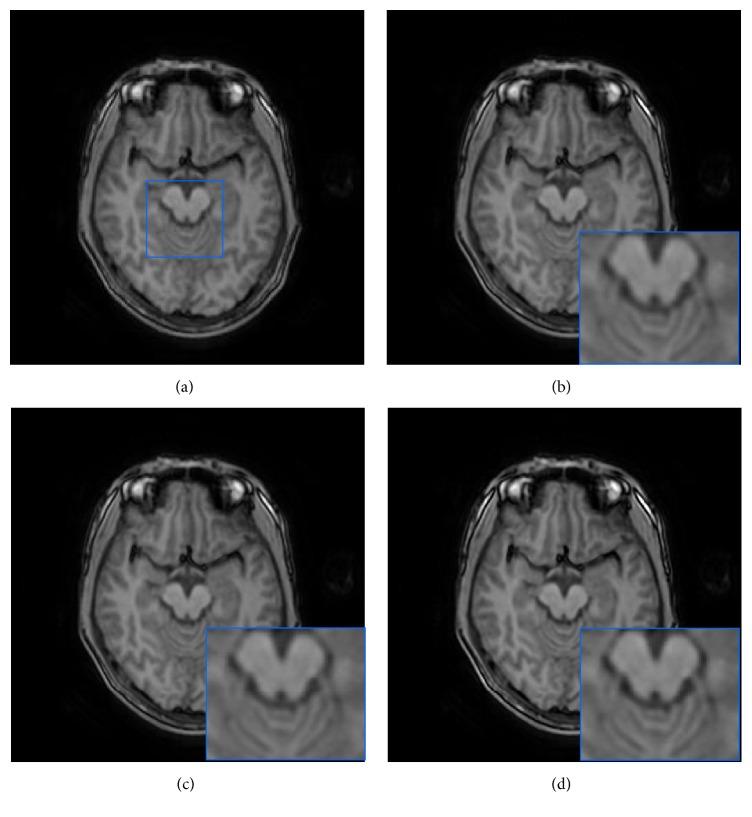 https://cdn.ncbi.nlm.nih.gov/pmc/blobs/ab02/5390603/50c4974bfa08/CMMM2017-6462832.007.jpg