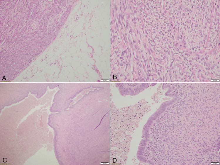 https://cdn.ncbi.nlm.nih.gov/pmc/blobs/ab04/11738093/f0800f36c9b6/cureus-0016-00000075829-i03.jpg