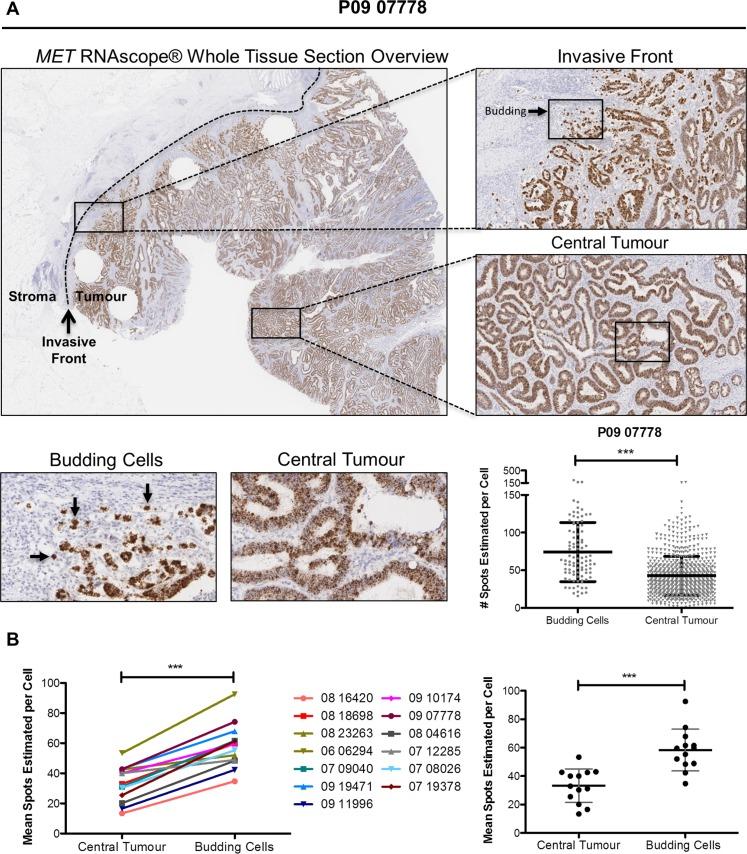 https://cdn.ncbi.nlm.nih.gov/pmc/blobs/ab06/5346688/e9b93b61f626/oncotarget-07-78932-g006.jpg