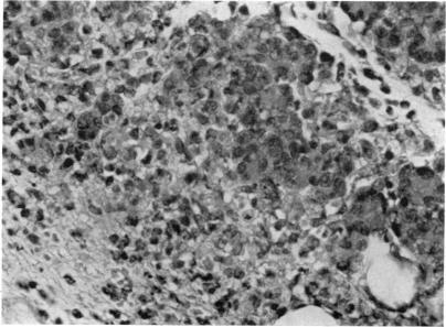 https://cdn.ncbi.nlm.nih.gov/pmc/blobs/ab08/1423110/936a4b91330f/immunology00324-0154-b.jpg