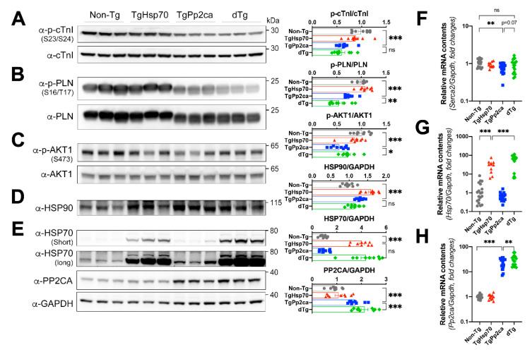 https://cdn.ncbi.nlm.nih.gov/pmc/blobs/ab0c/8624068/aa2adaaeec18/cells-10-03180-g006.jpg