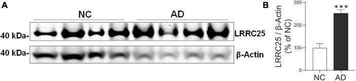 https://cdn.ncbi.nlm.nih.gov/pmc/blobs/ab0e/10929014/5d7d5de72e69/fnmol-17-1365752-g006.jpg