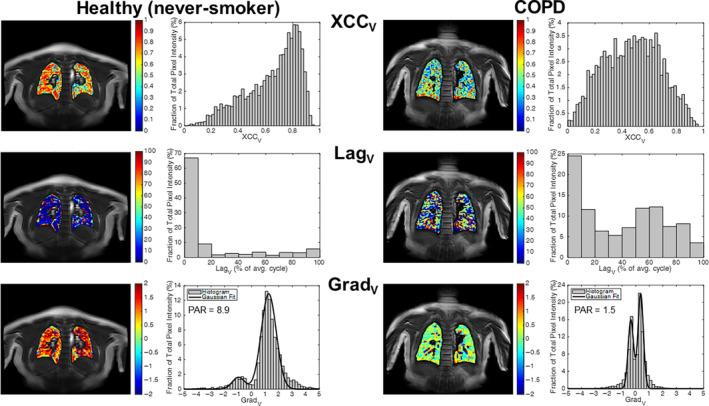 https://cdn.ncbi.nlm.nih.gov/pmc/blobs/ab0e/11706312/e9e705581de9/JMRI-61-663-g005.jpg