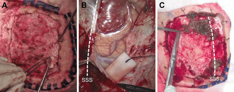 https://cdn.ncbi.nlm.nih.gov/pmc/blobs/ab0f/11694846/2c82d2bc1e81/cureus-0016-00000074950-i03.jpg