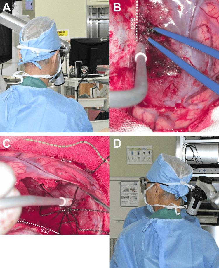 https://cdn.ncbi.nlm.nih.gov/pmc/blobs/ab0f/11694846/36ff849f40ab/cureus-0016-00000074950-i05.jpg