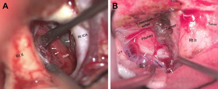 https://cdn.ncbi.nlm.nih.gov/pmc/blobs/ab0f/11694846/888a930ea307/cureus-0016-00000074950-i04.jpg