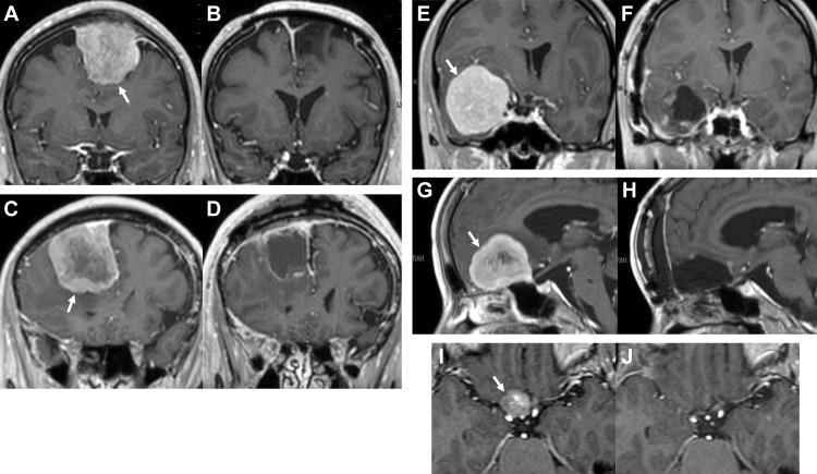 https://cdn.ncbi.nlm.nih.gov/pmc/blobs/ab0f/11694846/a6c81d04278c/cureus-0016-00000074950-i02.jpg