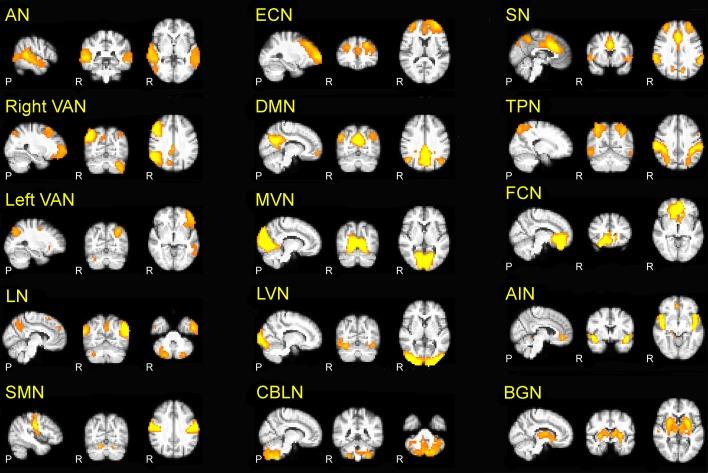 https://cdn.ncbi.nlm.nih.gov/pmc/blobs/ab11/4115623/16b556fa5a74/fnins-08-00223-g0001.jpg