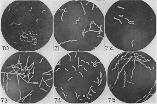 https://cdn.ncbi.nlm.nih.gov/pmc/blobs/ab19/440875/ac151596c7d2/bactrev00169-0107-b.jpg