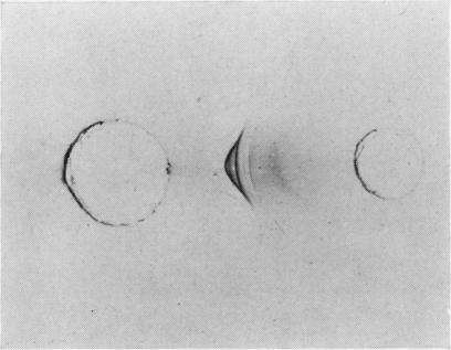 https://cdn.ncbi.nlm.nih.gov/pmc/blobs/ab23/473800/883e7b5d75ca/jclinpath00374-0077-c.jpg