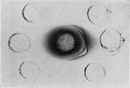 https://cdn.ncbi.nlm.nih.gov/pmc/blobs/ab23/473800/db9a00fa14b1/jclinpath00374-0079-a.jpg