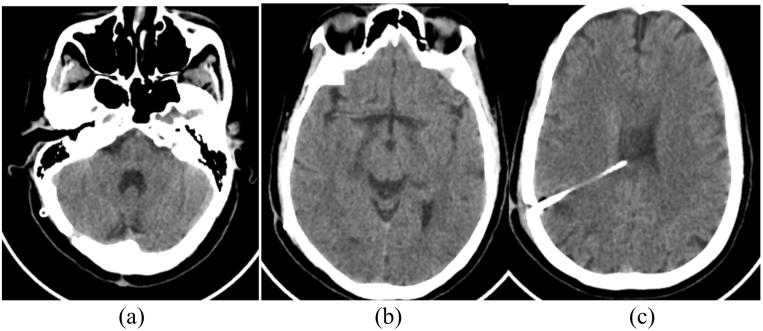 https://cdn.ncbi.nlm.nih.gov/pmc/blobs/ab29/9568752/fc0a8ca9c3fb/gr5.jpg
