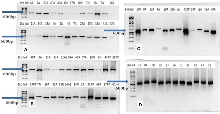 https://cdn.ncbi.nlm.nih.gov/pmc/blobs/ab32/9330904/9ca54bb904a2/fcimb-12-789157-g003.jpg