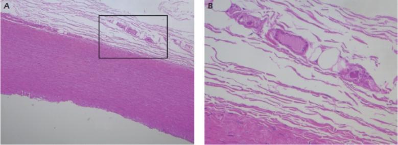 https://cdn.ncbi.nlm.nih.gov/pmc/blobs/ab33/11762605/043634cc9701/11239_2024_3028_Fig3_HTML.jpg
