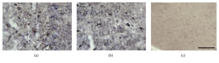 https://cdn.ncbi.nlm.nih.gov/pmc/blobs/ab38/5149707/2c52e949eef9/OMCL2016-3974648.002.jpg