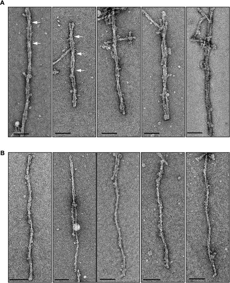 https://cdn.ncbi.nlm.nih.gov/pmc/blobs/ab3b/8195424/b716fad3cc96/ppat.1009628.g003.jpg