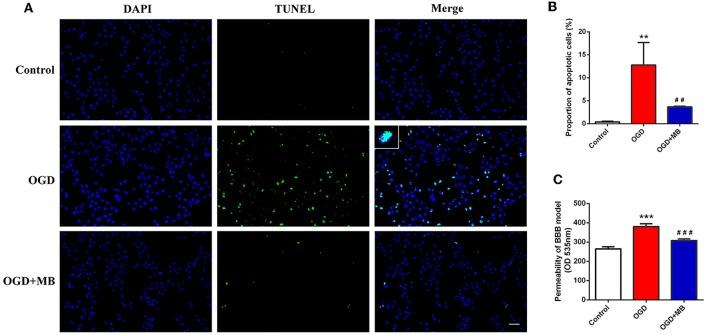 https://cdn.ncbi.nlm.nih.gov/pmc/blobs/ab4e/6856146/728b3eeb3782/fneur-10-01133-g0002.jpg