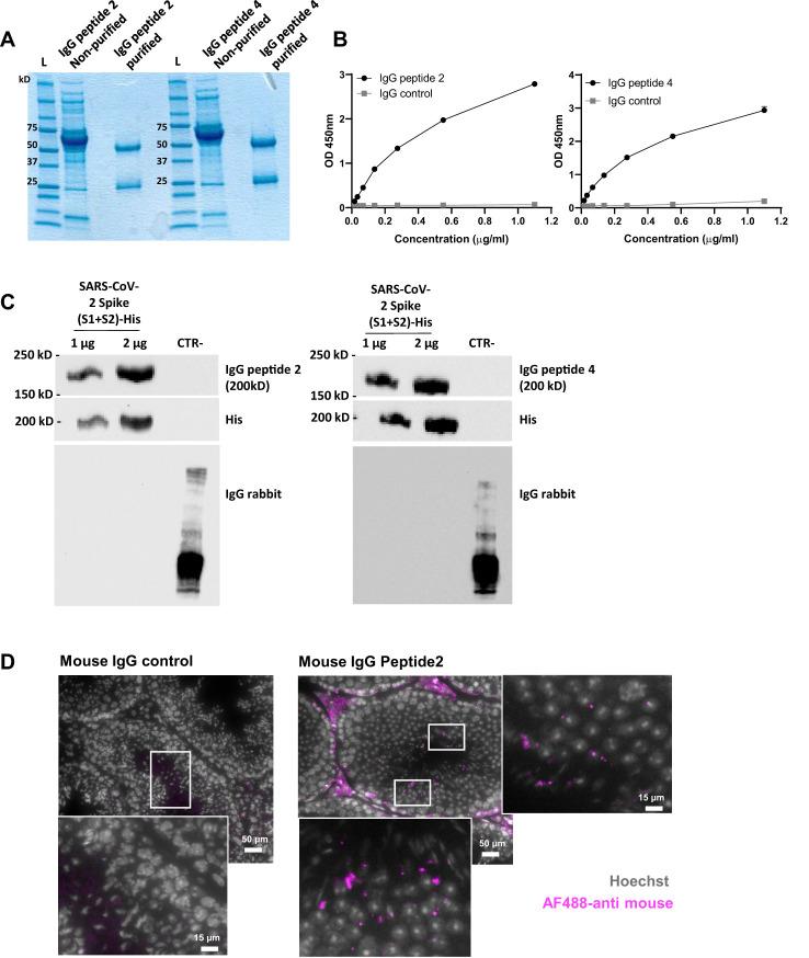 https://cdn.ncbi.nlm.nih.gov/pmc/blobs/ab50/12149208/4b687ca02f19/fimmu-16-1540341-g005.jpg