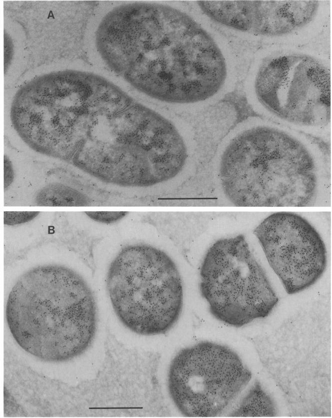 https://cdn.ncbi.nlm.nih.gov/pmc/blobs/ab51/214492/698d00e38da8/jbacter00214-0095-a.jpg