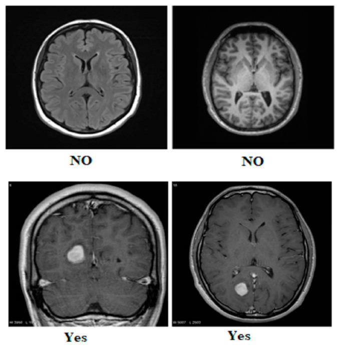 https://cdn.ncbi.nlm.nih.gov/pmc/blobs/ab53/11353951/42fc752182ef/diagnostics-14-01714-g002.jpg