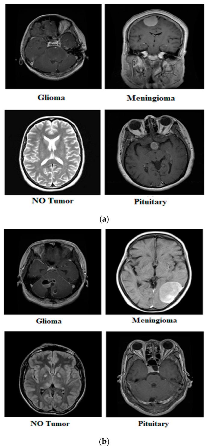 https://cdn.ncbi.nlm.nih.gov/pmc/blobs/ab53/11353951/ed0b792533af/diagnostics-14-01714-g003.jpg