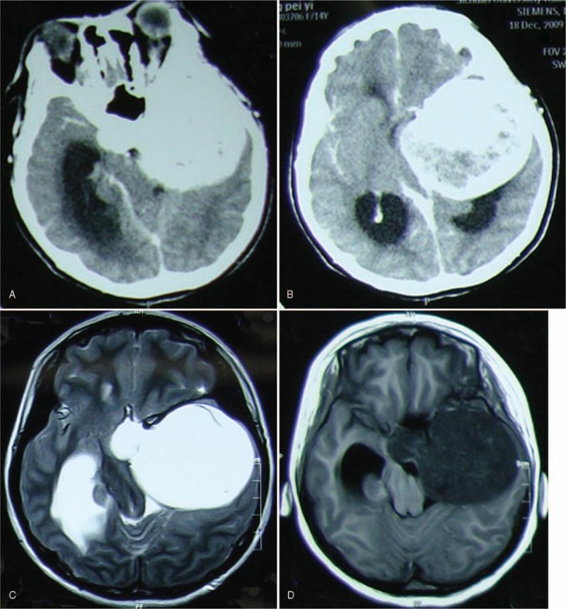 https://cdn.ncbi.nlm.nih.gov/pmc/blobs/ab53/6221700/25fac823195d/medi-97-e13098-g001.jpg