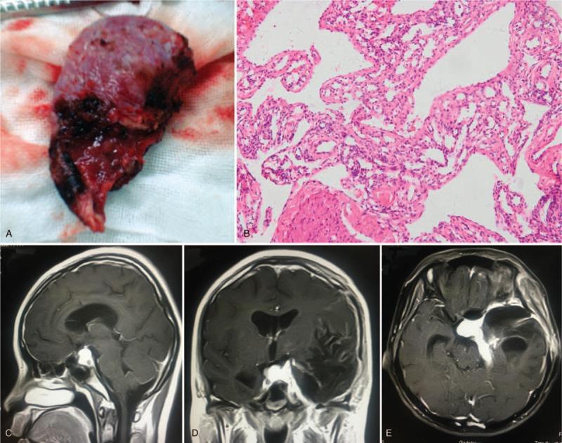 https://cdn.ncbi.nlm.nih.gov/pmc/blobs/ab53/6221700/d76ff3c84ece/medi-97-e13098-g003.jpg