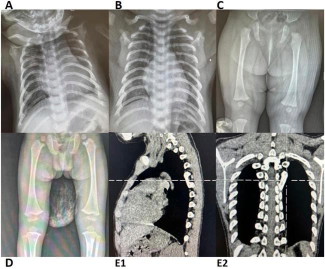 https://cdn.ncbi.nlm.nih.gov/pmc/blobs/ab5f/12213692/3e74e2e8ef78/fgene-16-1603782-g001.jpg