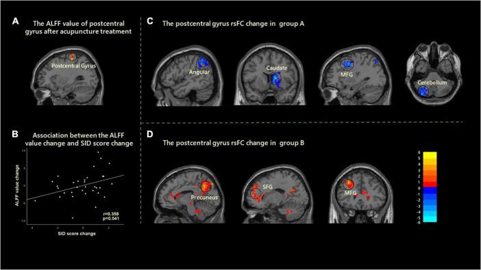 https://cdn.ncbi.nlm.nih.gov/pmc/blobs/ab60/9108289/f7d2ea132848/fnins-16-819310-g002.jpg