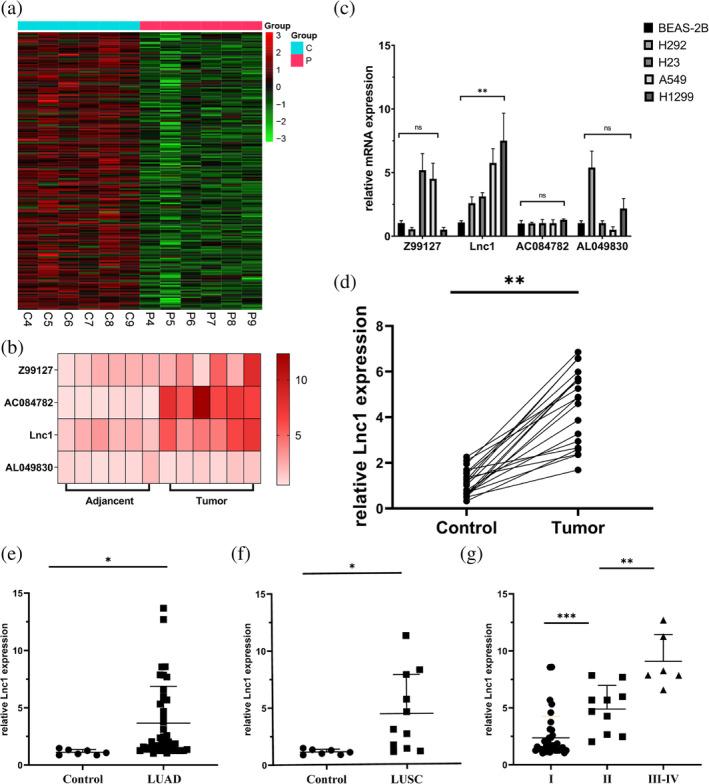 https://cdn.ncbi.nlm.nih.gov/pmc/blobs/ab62/11219295/55ea297feccc/TCA-15-1477-g001.jpg