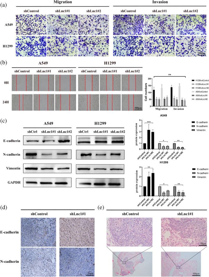 https://cdn.ncbi.nlm.nih.gov/pmc/blobs/ab62/11219295/d10913e84c31/TCA-15-1477-g005.jpg