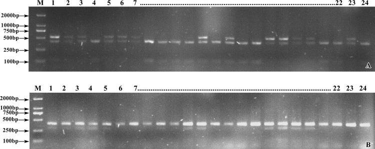 https://cdn.ncbi.nlm.nih.gov/pmc/blobs/ab6a/8691606/cb4177523b76/pone.0261403.g006.jpg