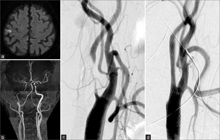 https://cdn.ncbi.nlm.nih.gov/pmc/blobs/ab6f/9168307/acdfdc2b20f3/SNI-13-192-g001.jpg