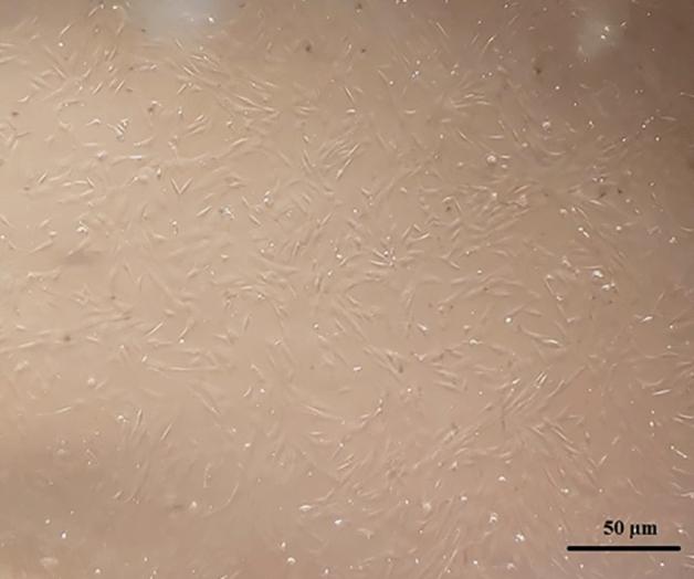 https://cdn.ncbi.nlm.nih.gov/pmc/blobs/ab70/10762099/b2c93ba962f7/41598_2023_50664_Fig10_HTML.jpg