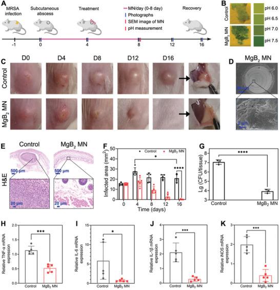https://cdn.ncbi.nlm.nih.gov/pmc/blobs/ab75/11186059/191e963fe861/ADVS-11-2309622-g003.jpg