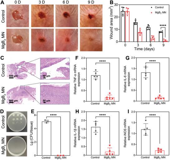 https://cdn.ncbi.nlm.nih.gov/pmc/blobs/ab75/11186059/d7d1ec6c3a93/ADVS-11-2309622-g008.jpg
